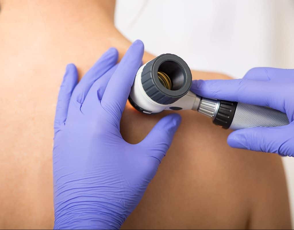 Dermatologist examining skin with dermatoscope