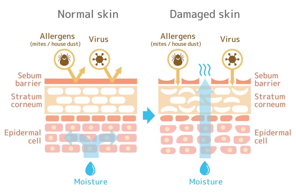 Skin barrier function infographic